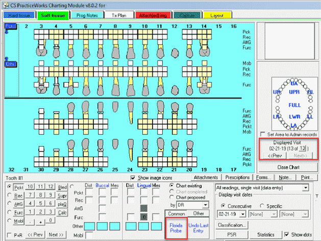 Eaglesoft Quick Charting